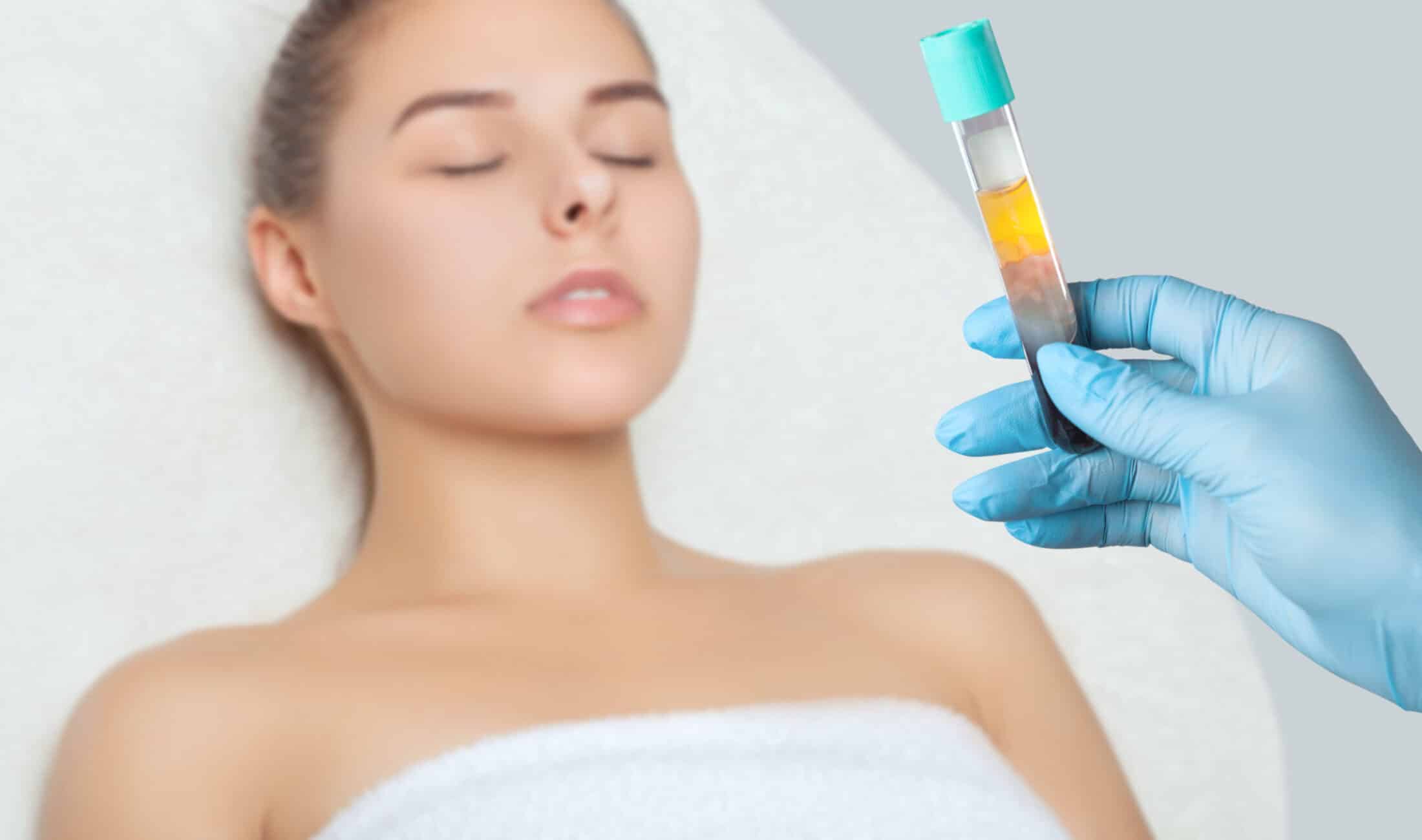 Plasma Injections | Carmel & Indianapolis, IN | Wise Aesthetics